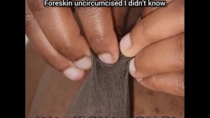 Foreskin Uncircumcised Fetish she didn't know